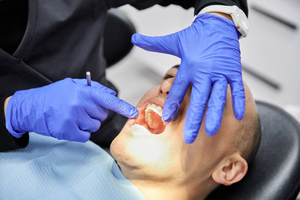 Best Emergency Tooth Extraction in Tice, FL