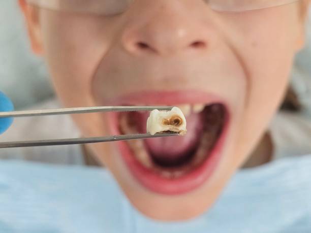 Best Emergency Denture Repair in Tice, FL